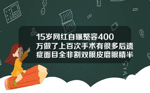 15岁网红自曝整容400万做了上百次手术有很多后遗症面目全非割双眼皮磨眼睛半年了一直磨眼睛